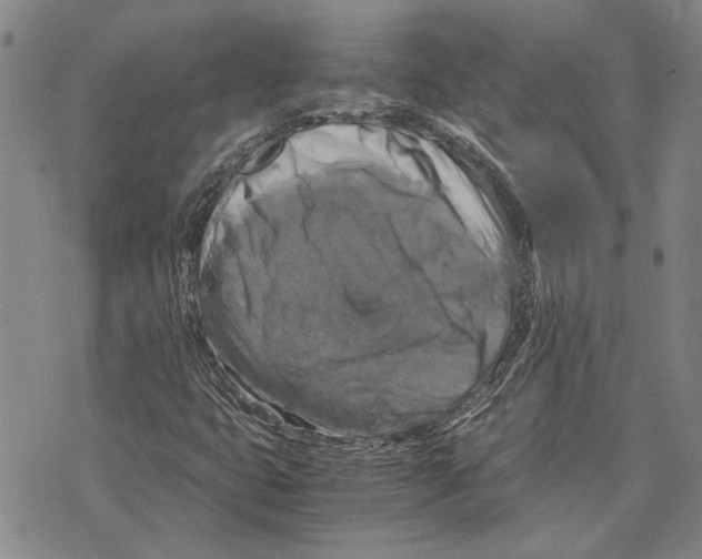 X0000075811399200610151418