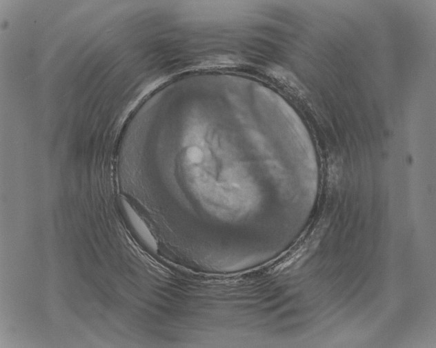 X0000075811409200610151418