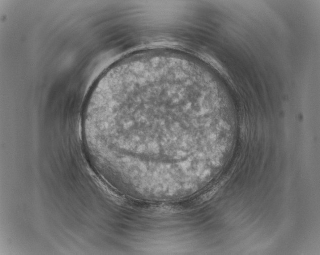 X0000075811420200610151418