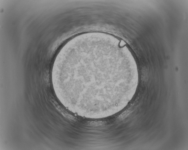 X0000075811499200610151417