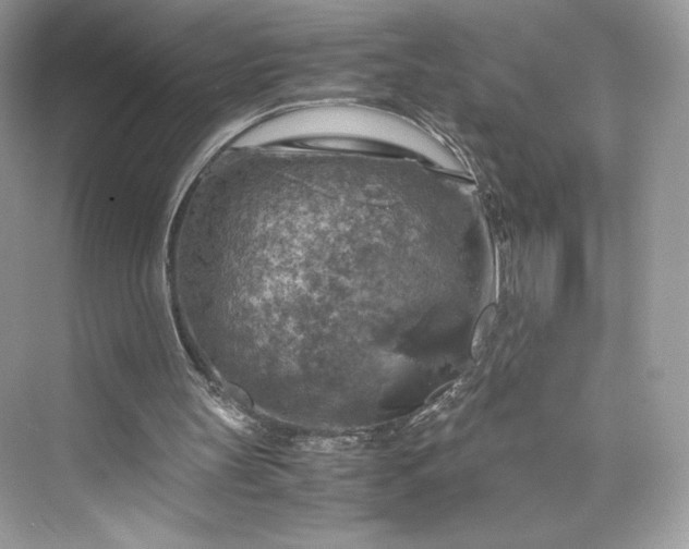 X0000075820147200609291420