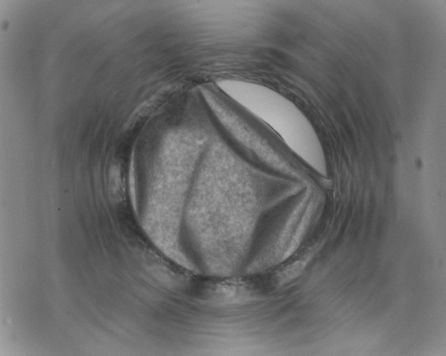 X0000075820420200610151500