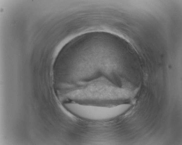 X0000075831519200610061809