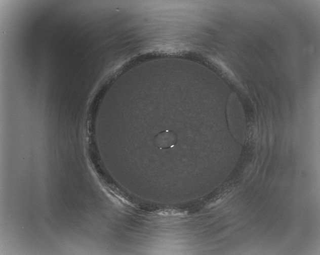 X0000075840736200609151304