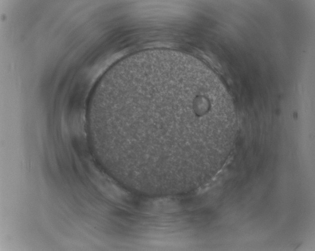 X0000075840146200610061855