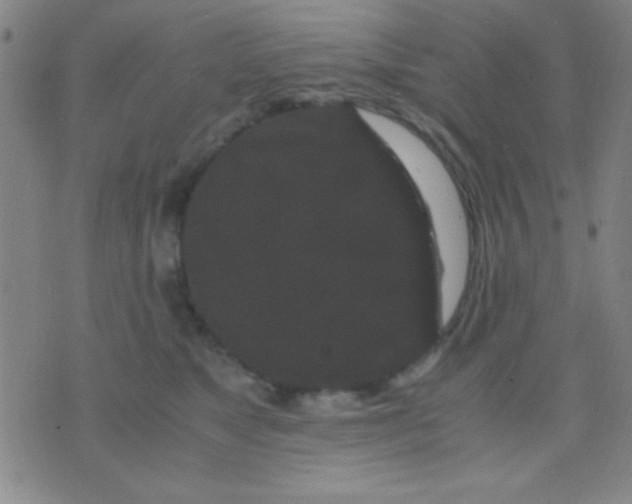 X0000075840517200610061850