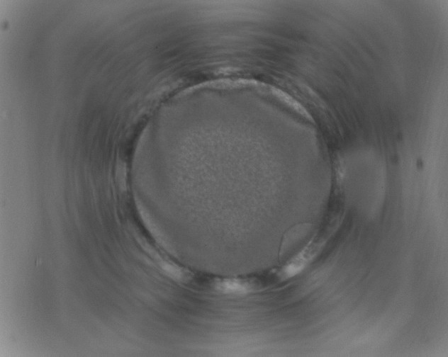 X0000075840565200610061850