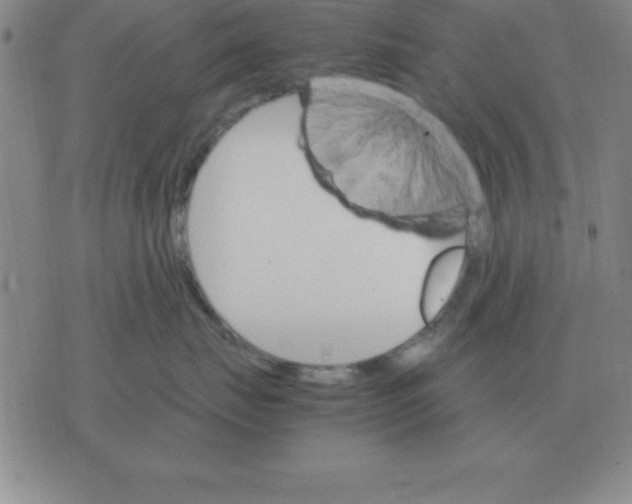 X0000075860671200610061938