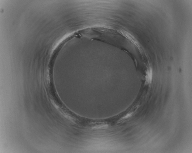 X0000075860676200610061938