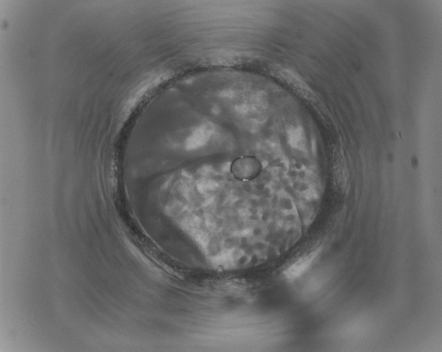 X0000075860683200610061938