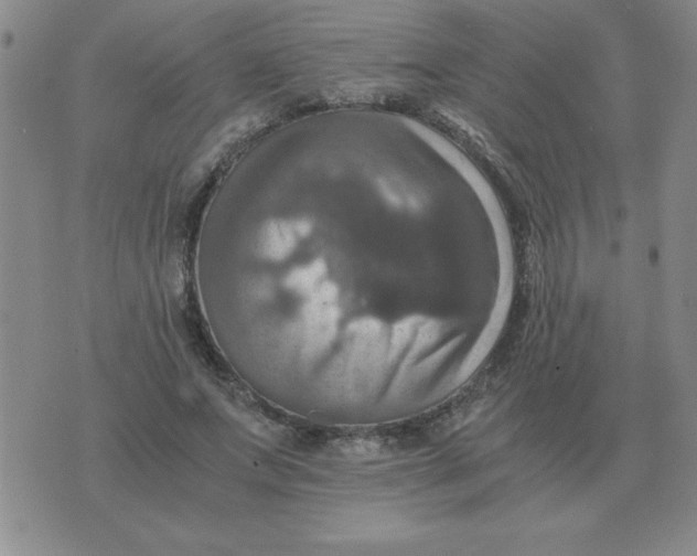 X0000075860687200610061938