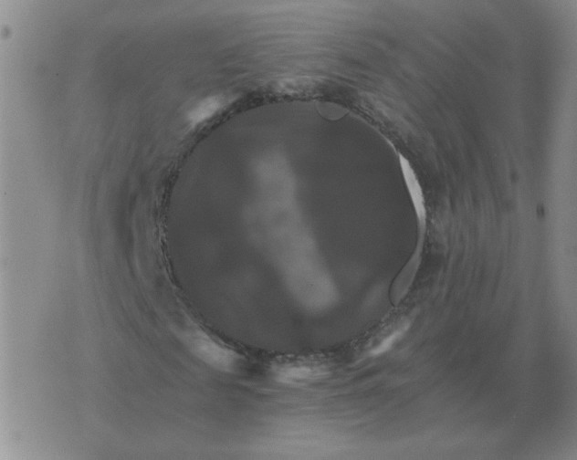 X0000075860817200610061935