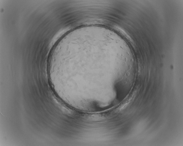 X0000075860986200610061933