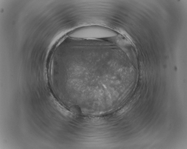 X0000075861072200610061931