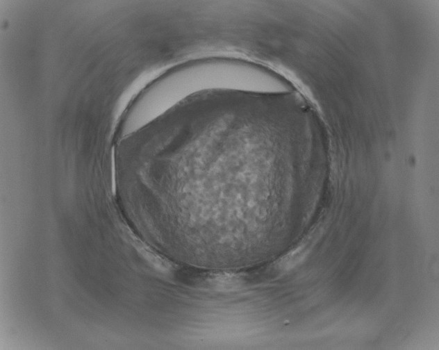 X0000075861175200610061930