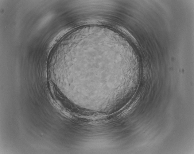 X0000075860938200610151632
