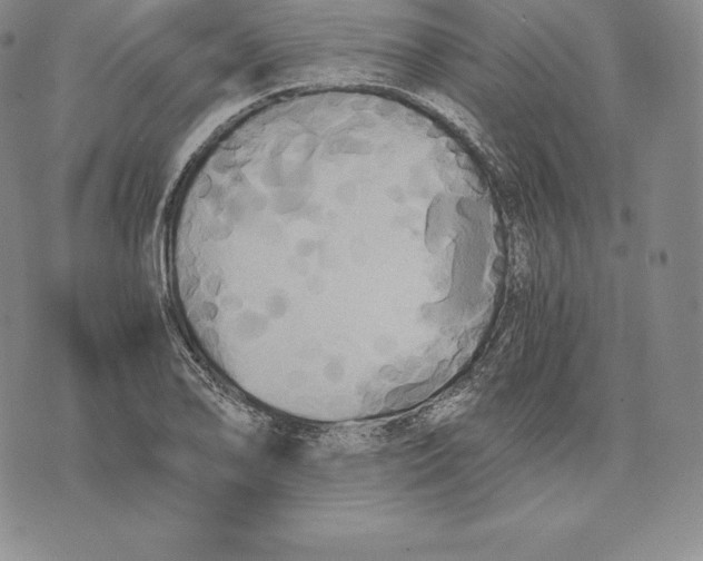 X0000075861078200610151629