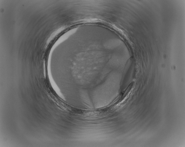 X0000075861171200610151628