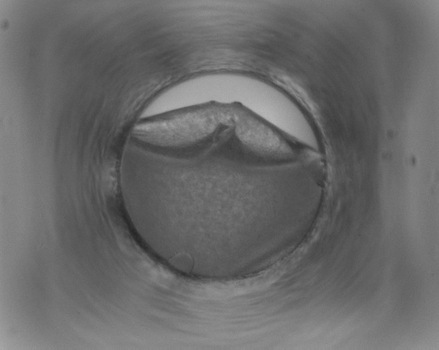 X0000075870017200610062014