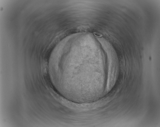 X0000075870038200610062014