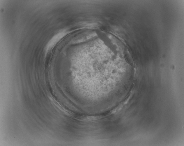 X0000075870149200610062011