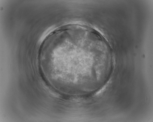 X0000075870199200610062011