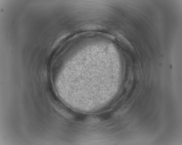 X0000075870207200610062011