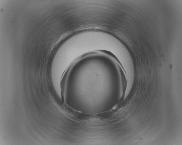 X0000075870256200610062010