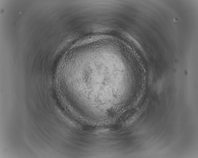 X0000075870257200610062010