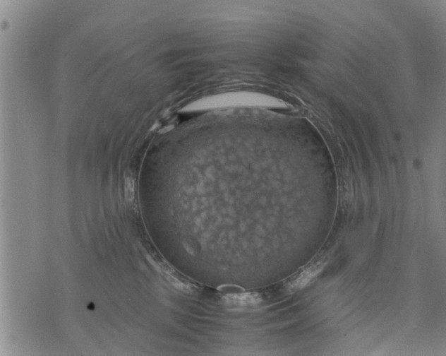 X0000075870281200610062010