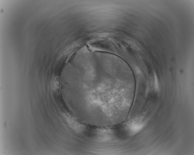 X0000075870284200610062010