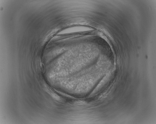 X0000075870397200610062008