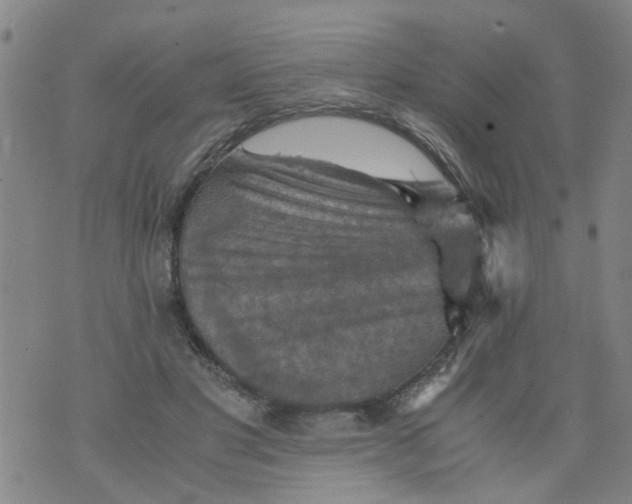 X0000075870501200610062006