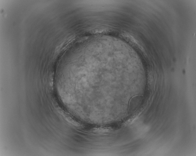 X0000075870545200610062005