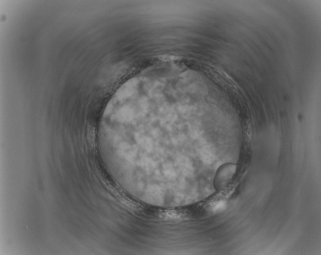 X0000075870565200610062005