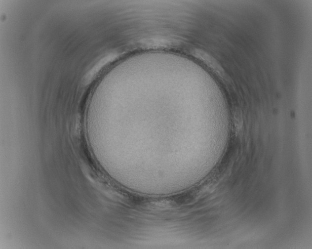 X0000075870583200610062005