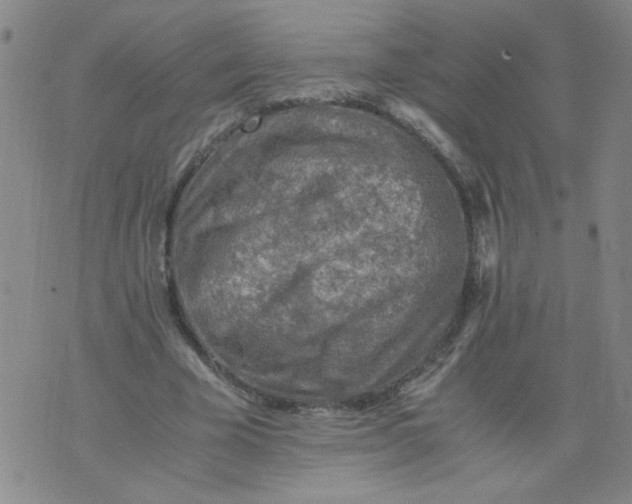 X0000075870585200610062005