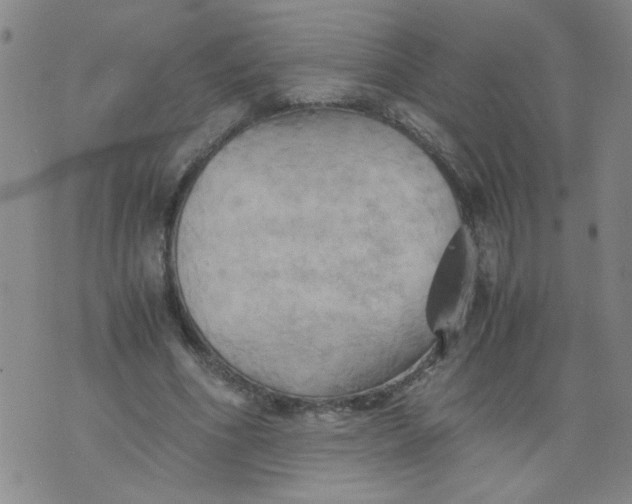 X0000075870586200610062005