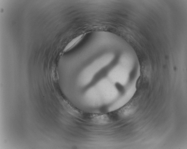 X0000075890185200610062102