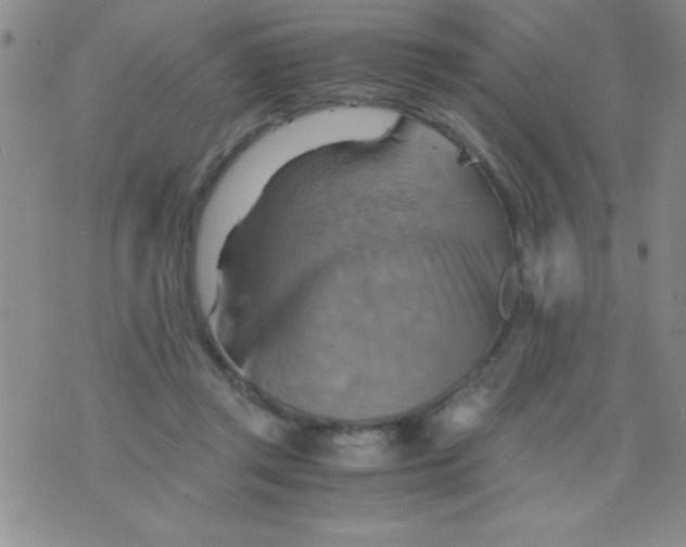 X0000075890357200610062058