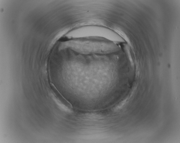 X0000075890389200610062058