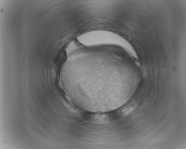 X0000075890570200610062056