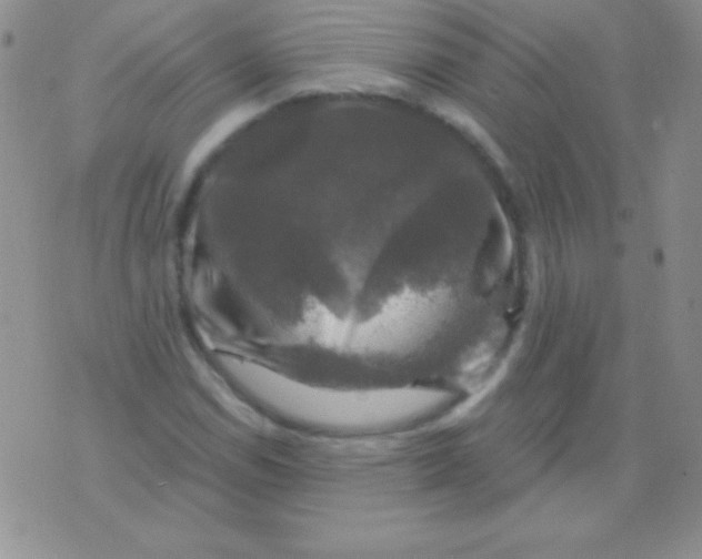 X0000075901114200610062111