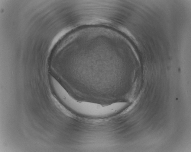 X0000075901122200610062111