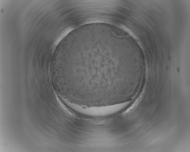 X0000075901137200610062111