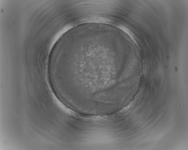 X0000075901139200610062111