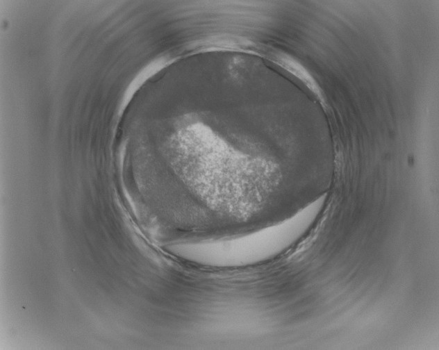 X0000075901146200610062111