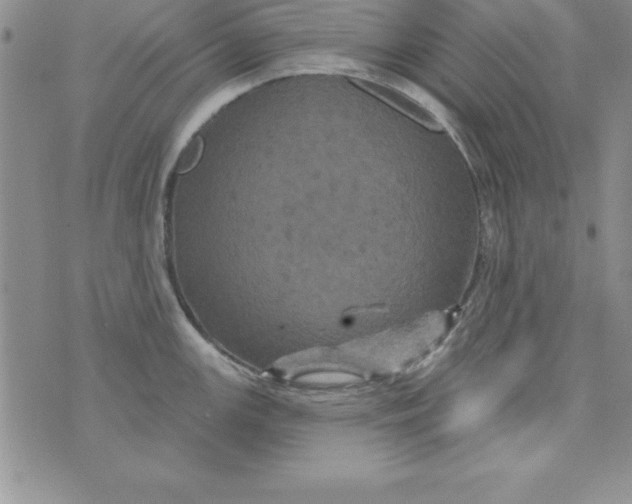 X0000075901147200610062111