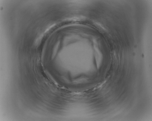 X0000075901158200610062110