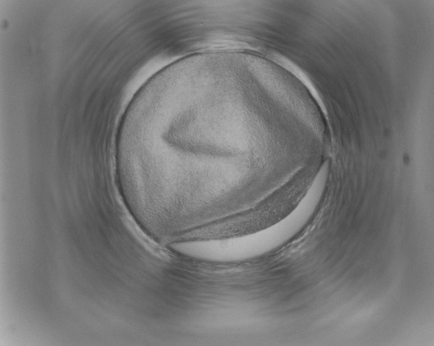 X0000075901195200610062110